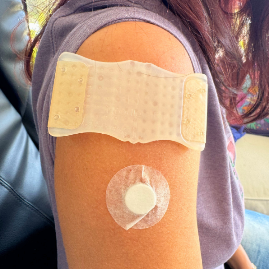 NeedleCalm Densensiting Adhesive Patches