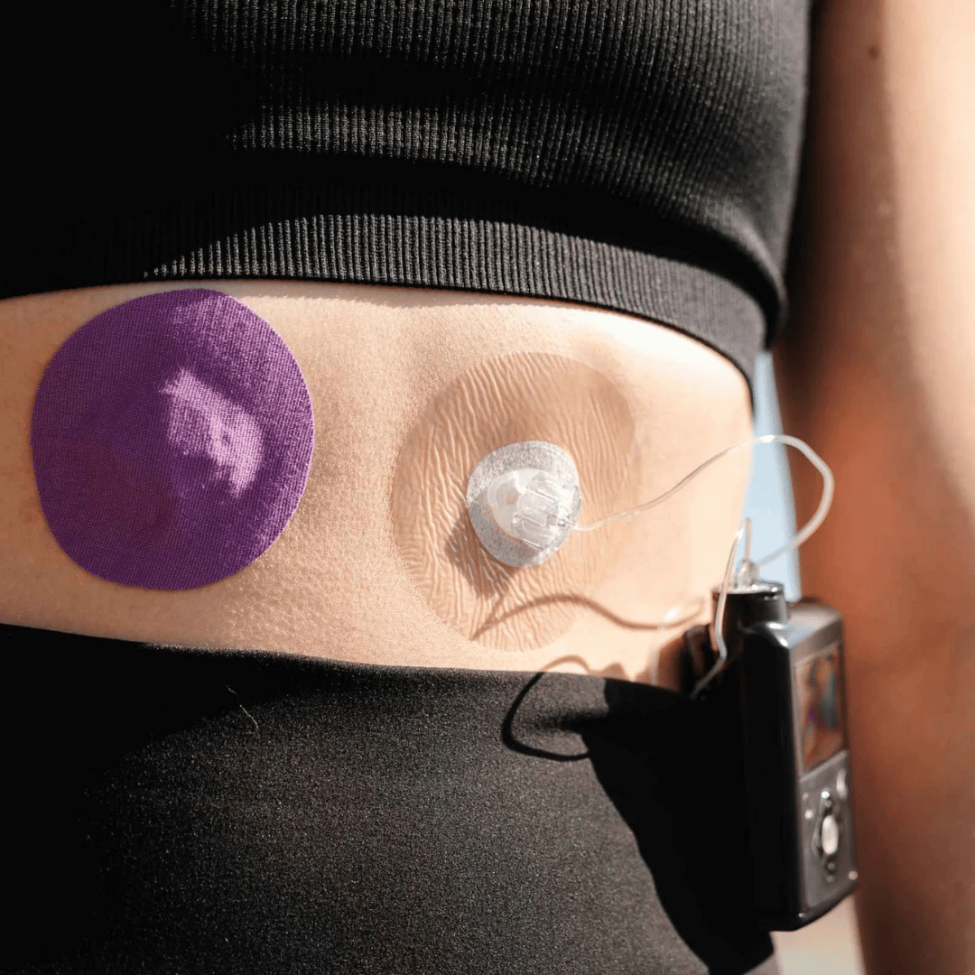 Type Strong Infusion Set Patches